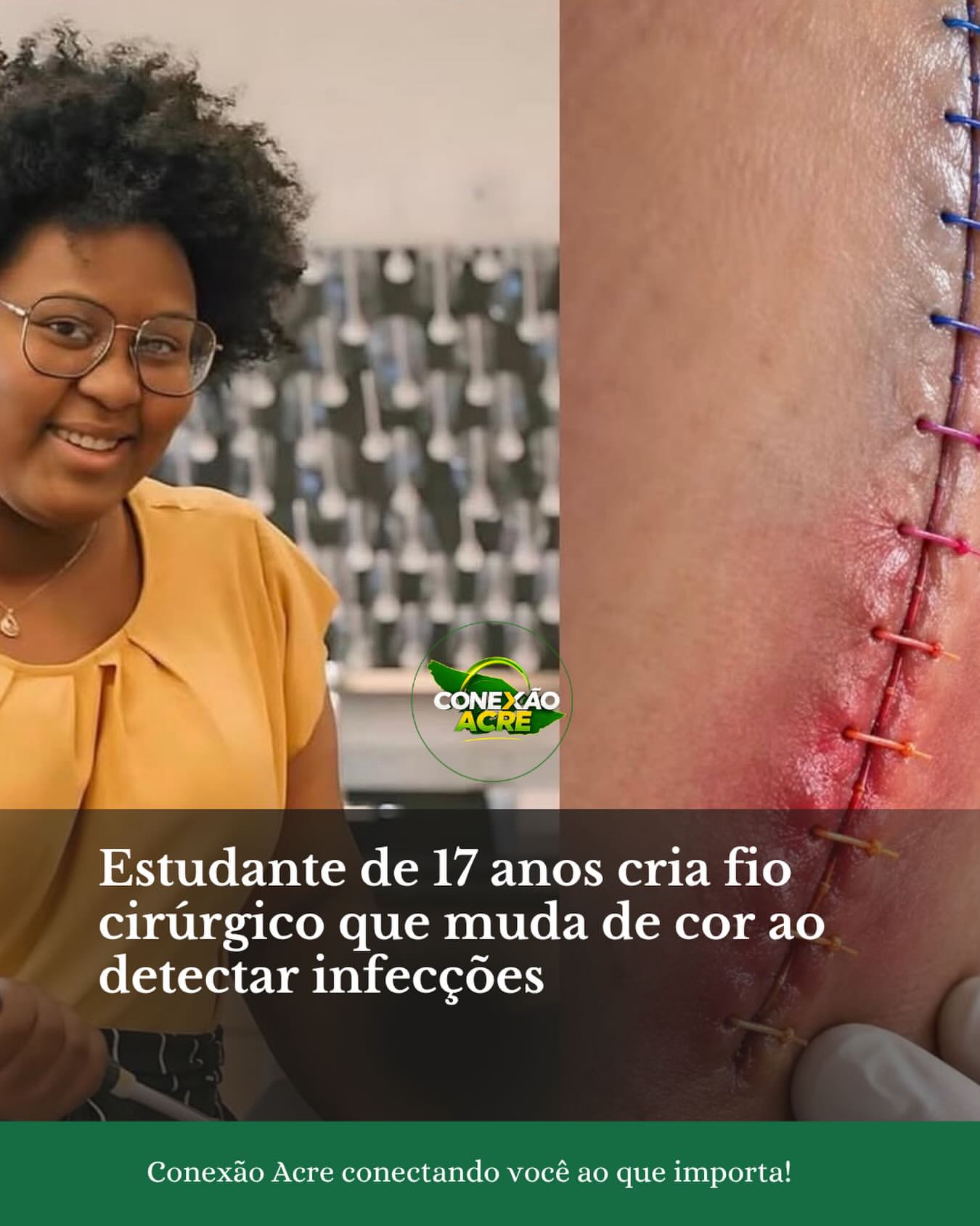 Estudante de 17 anos cria fio cirúrgico que muda de cor ao detectar infecções